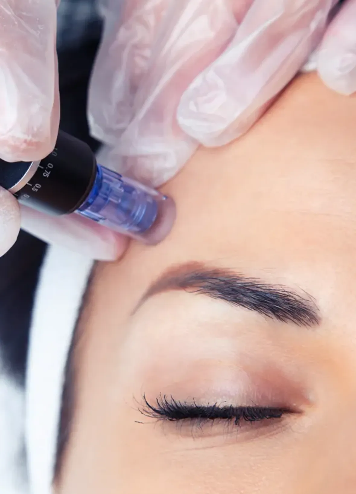 SomaVie Wellness Hydrodermabrasion and Dermaplaning